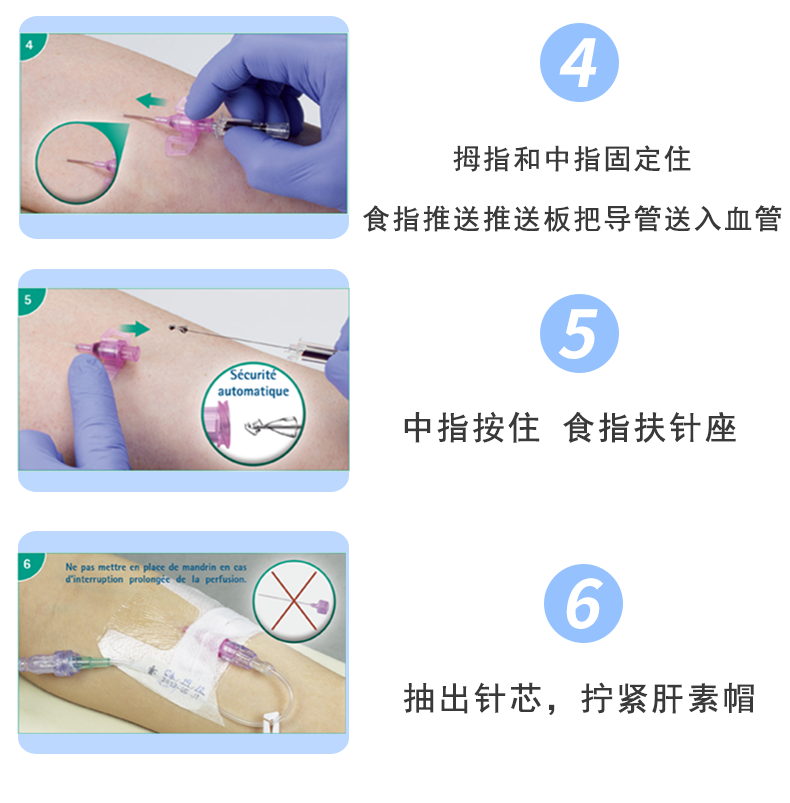 德國(guó)貝朗Introcan Safety-W 英全康18G 安全型 帶翼動(dòng)靜脈留置針