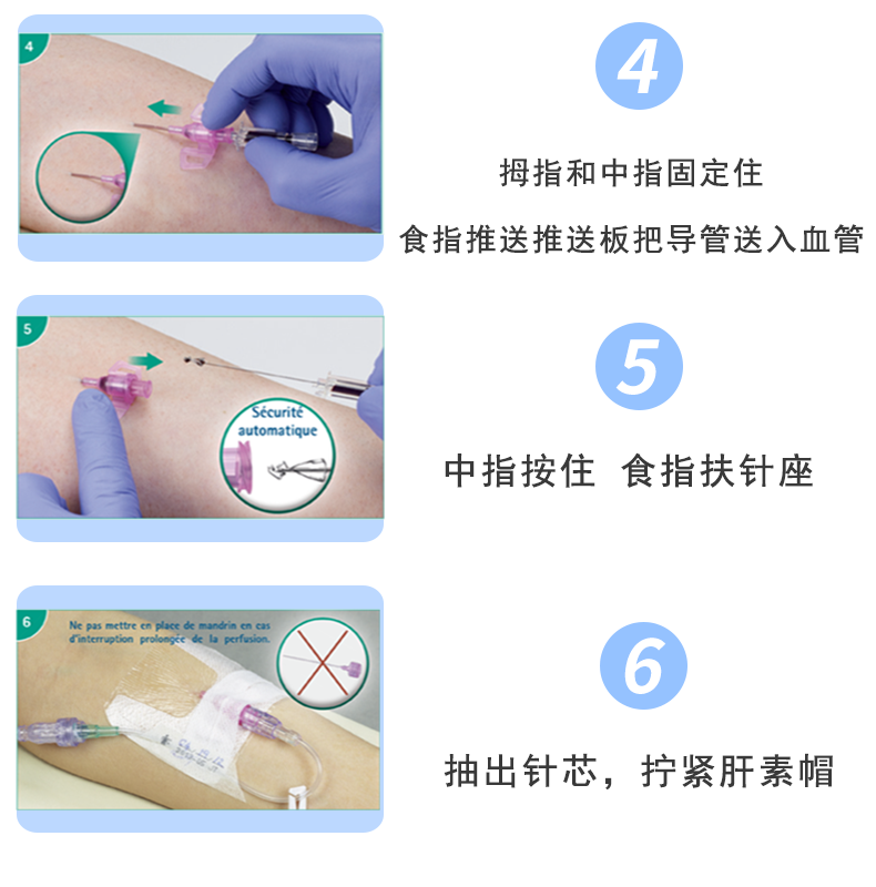 英全康20G動靜脈留置針