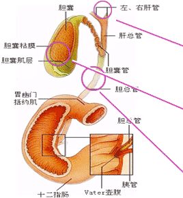 膽結(jié)石